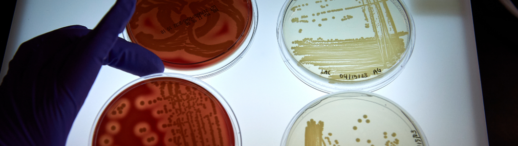 enviromental microbiology