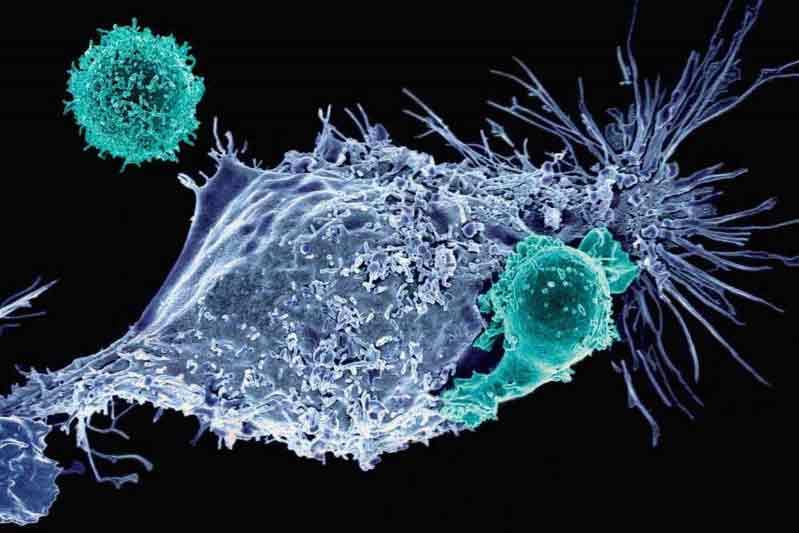 cancer cell